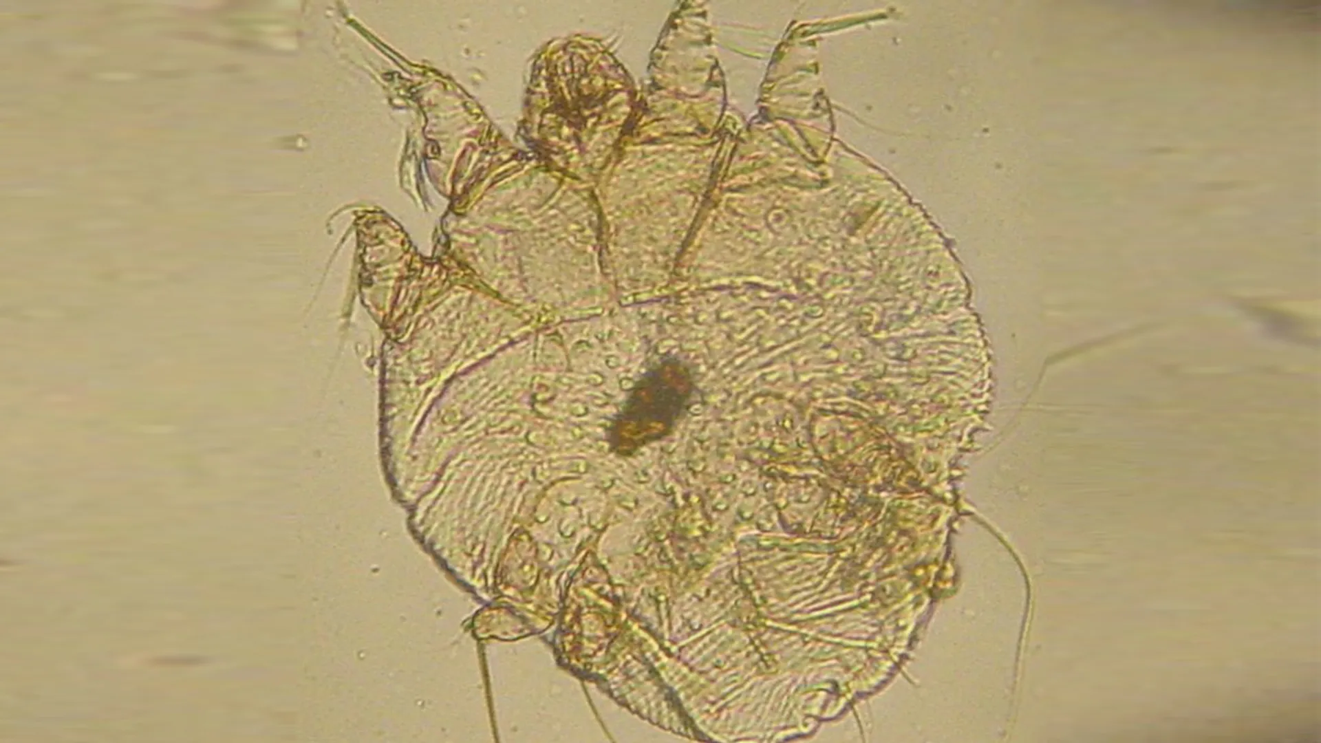 schurft scabies