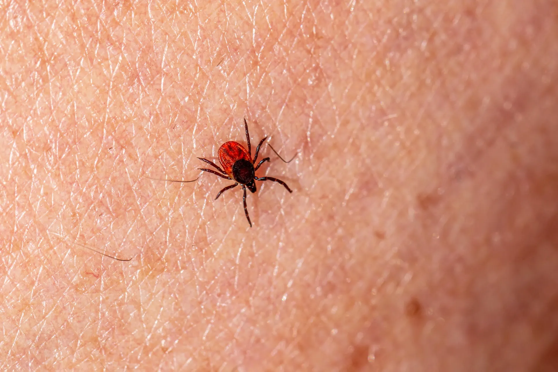 Afbeelding van Hoe is het om de ziekte van Lyme te hebben?